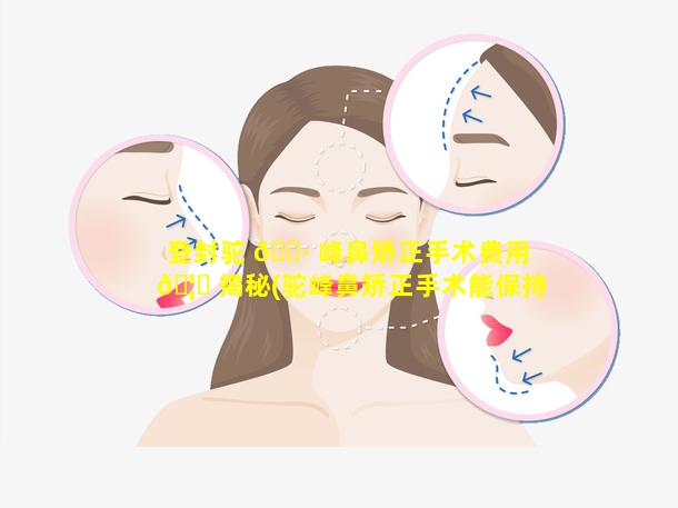 登封驼 🌷 峰鼻矫正手术费用 🦈 揭秘(驼峰鼻矫正手术能保持多久)